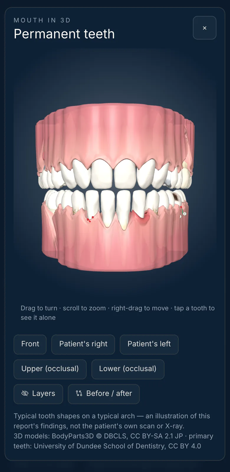 Mouth in 3D on a phone: both arches with the gum and the view buttons