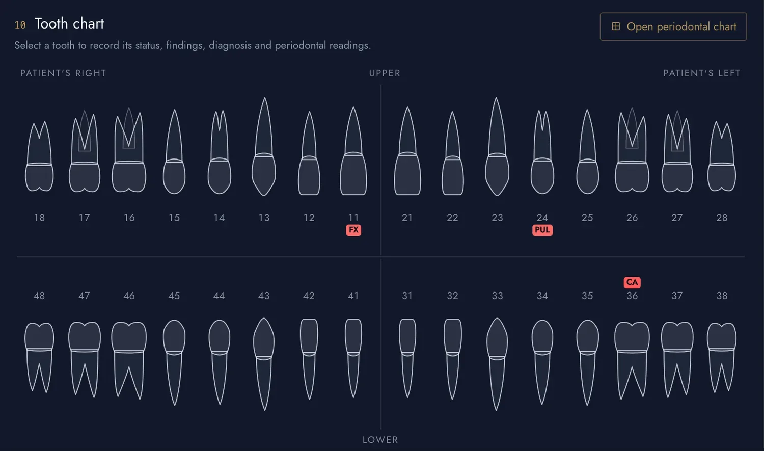 The tooth chart marks 11 fracture, 24 pulpitis and 36 caries, each on its own tooth