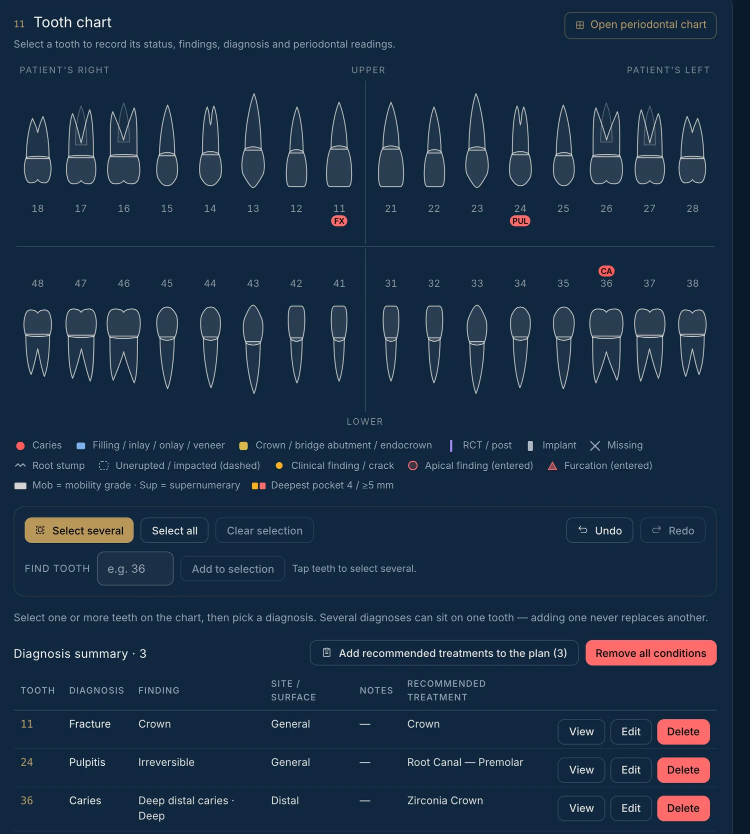 The tooth chart marks fractures, pulpitis and caries each on its own tooth, filled from the doctor’s dictation